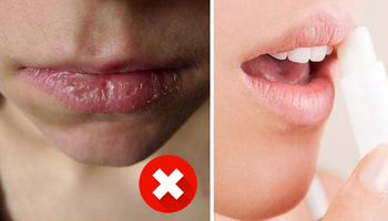 12 sprawdzonych metod na suche usta. Przyniosą ukojenie, a także zniwelują zaczerwienienie