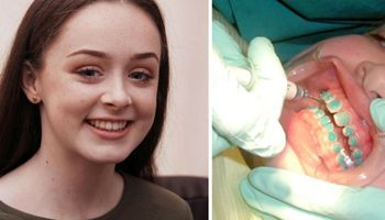 Nastolatka prawie umiera tydzień po założeniu aparatu na zęby!