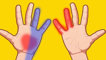 O poważnych chorobach dowiesz się z dłoni. Odczytasz alergie, odwodnienie i problemy z kręgosłupem