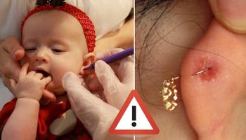 Nie przekłuwaj uszu swojego małego dziecka! Narażasz je na alergie w dorosłym życiu