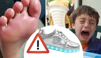 Uważajcie na popularne buty LED. Spowodowały u dziecka oparzenie II stopnia