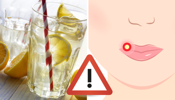 5 złych rzeczy, które może wywołać codzienne picie wody z cytryną. O tym się nie mówi!