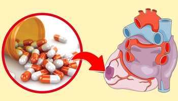 Ibuprofen zwiększa ryzyko zawału o 50%! Niepokojące statystyki!
