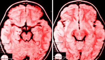 Neurolodzy odkryli co narzekanie robi z mózgiem. Jest tylko jeden sposób, by cofnąć zmiany