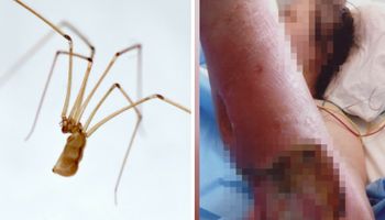 Kobietę z podkarpacia ugryzł pajak. Posadził ją na wózek do końca życia