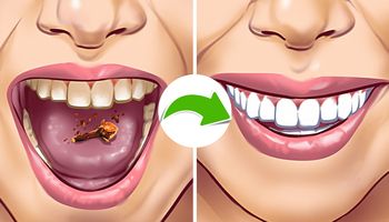 6 nietypowych sposobów na usunięcie kamienia na zębach i pozbycie się nieświeżego oddechu