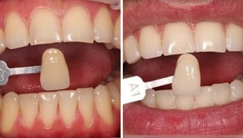 7 wskazówek dentystów o pielęgnacji zębów, których lekceważenie przyniesie przykre konsekwencje