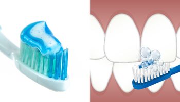 7 najczęstszych błędów, które popełniamy w trosce o swoje zęby