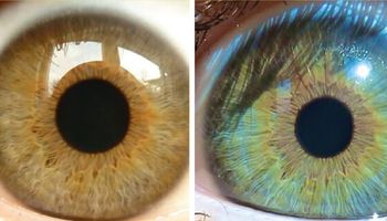 7 czynników, które mogą zmienić kolor Twoich oczu. To naprawdę możliwe!