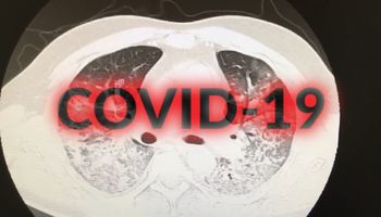 Co COVID-19 robi z płucami człowieka? Doktor omówił to na nagraniu