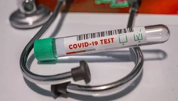 Ekspertka wyjaśnia, dlaczego spada liczba wykonywanych testów na COVID-19