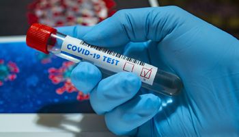 Badacze wskazali grupę ludzi, którzy są mniej podatni na zakażenie koronawirusem SARS-CoV-2