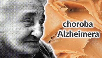 Opracowali test z użyciem masła orzechowego, który pozwala wykryć początki choroby Alzheimera