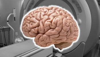Badacze z Berkeley odkryli, jakie zmiany zachodzą w mózgu, gdy coś sobie wyobrażamy