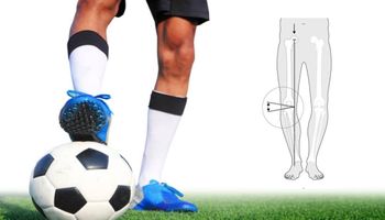 „Krzywe nogi”, czyli choroba zawodowa piłkarzy. Zmianom przyjrzeli się chirurdzy