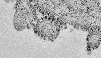 Naukowcy obliczyli przybliżoną masę wszystkich cząsteczek wirusa SARS-CoV-2, który infekuje ludzi