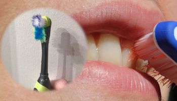 4 oznaki, które mogą świadczyć o tym, że zbyt mocno szczotkujesz zęby. Czas to zmienić