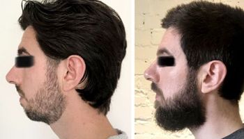 15 zdjęć, które dowodzą, że broda zmienia wygląd bardziej niż niejedna operacja plastyczna
