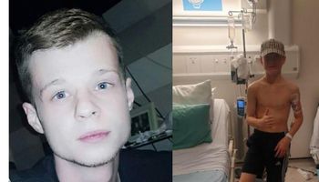 Mama 14-letniego chłopca ostrzega. Swędzenie rąk okazało się być objawem raka