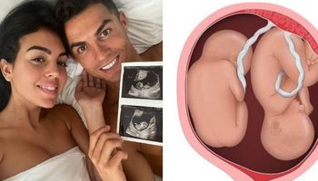 Syn Cristiano Ronaldo zmarł od razu po porodzie. Niebezpieczeństwa związane z bliźniaczą ciążą