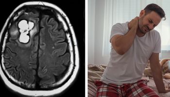 Objawy guza mózgu, które ujawniają się tuż po przebudzeniu