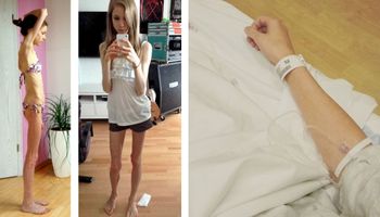 W najgorszym momencie swojego życia ważyła tylko 22 kg. Teraz jej ciało zmieniło się nie do poznania