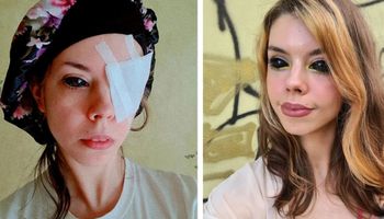 Wytatuowała sobie gałki oczne, w wyniku czego straciła wzrok. Tatuażysta stanął przed sądem