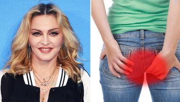 Madonna pielęgnuje swoją twarz maścią na hemoroidy. Inne gwiazdy ją naśladują