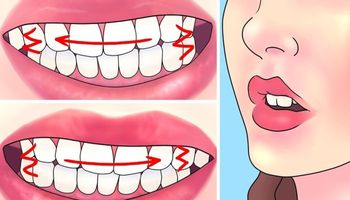 7 rzeczy, które pomogą Ci zredukować zgrzytanie zębami
