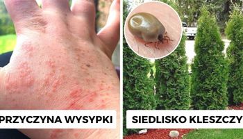 Roślina, która jest toksyczna i szkodzi zdrowiu?! Prawie każdy Polak ma ją w swoim ogrodzie
