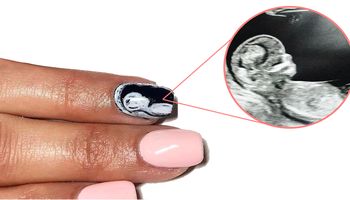 Ultrasonograficzne zdjęcia na paznokciach. Nowy trend czy kit?