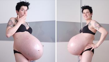 kobieta w ciąży z bliźniakami