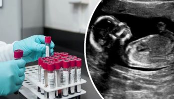 Test PAPP-A w ciąży. Czym jest i po co się go wykonuje?