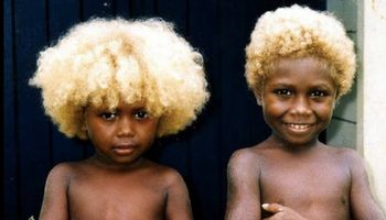 Nikt nie wie, dlaczego te ciemnoskóre dzieci mają blond włosy. Wyniki DNA zaskakują