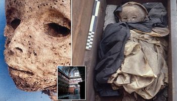 Badania ponad 400-letniej mumii ujawniły ważne informacje o wirusowym zapaleniu wątroby typu B