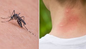 Komary gryzą cię znacznie częściej niż innych? Biolodzy wyjaśniają, dlaczego tak się dzieje