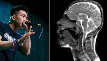 Zobacz, co dzieje się w aparacie głosowym beatboxera w akcji podczas rezonansu magnetycznego