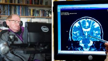 Naukowcy uczą się „języka mózgu”, by opracować system, który zamieni nasze myśli na mowę