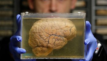 Naukowcy wyhodowali mini-mózgi, których wzorce do złudzenia przypominają aktywność u wcześniaków