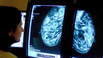 Szwajcarski zespół z powodzeniem zamienił ludzkie komórki raka piersi w komórki tłuszczowe
