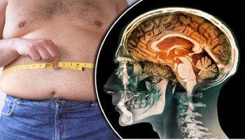 Badanie ujawnia, że otyłość ma negatywny wpływ na nasz mózg. Skany MRI pokazują uszkodzenia