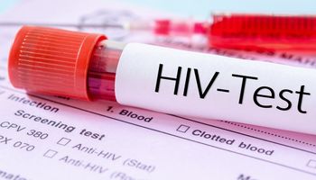 Pacjent z wirusem HIV pozostaje w stanie długotrwałej remisji. Prognozy są bardzo optymistyczne