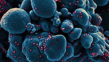 Zdjęcia z mikroskopu elektronowego pokazują, jak koronawirus SARS-CoV-2 „zabija” ludzkie komórki