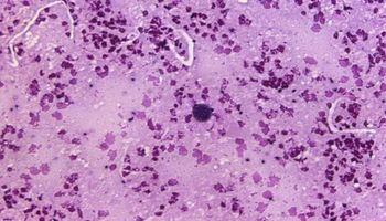 Toxoplasma gondii, czyli maleńki pasożyt, który może zainfekować mózg i zmienić twoje zachowanie