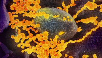 Naukowcy zidentyfikowali, które komórki w ludzkich ciele są głównie atakowane przez koronawirusa