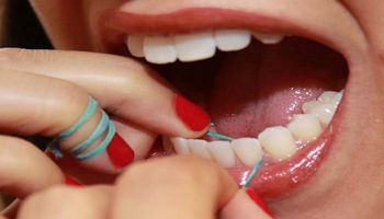Warto pamiętać o regularnym nitkowaniu zębów. W ten sposób oszczędzimy sobie sporo kłopotów