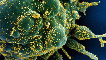 Nowe badania ujawnia, że odporność komórkowa na SARS-CoV-2 trwa nawet 6 miesięcy