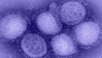 W Kanadzie zgłoszono pierwszy przypadek rzadkiego wariantu grypy H1N2 u człowieka