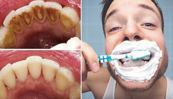 Dentyści ustalili, czy należy myć zęby przed śniadaniem, czy też po pierwszym posiłku