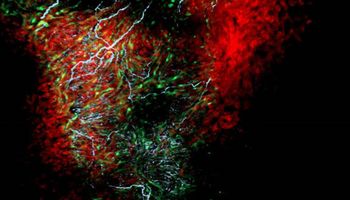 Zespół naukowców odkrył nowy typ komórek znajdujących się w sercu
